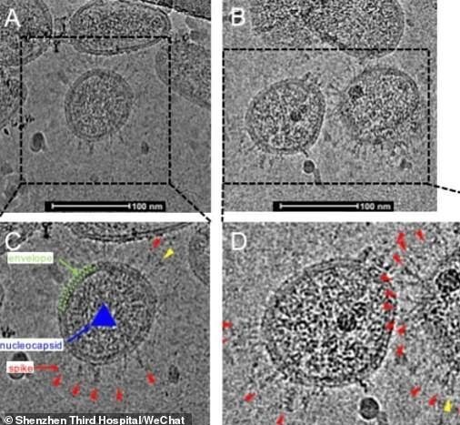 عکس/ ظاهر واقعی کرونا زیر میکروسکوپ