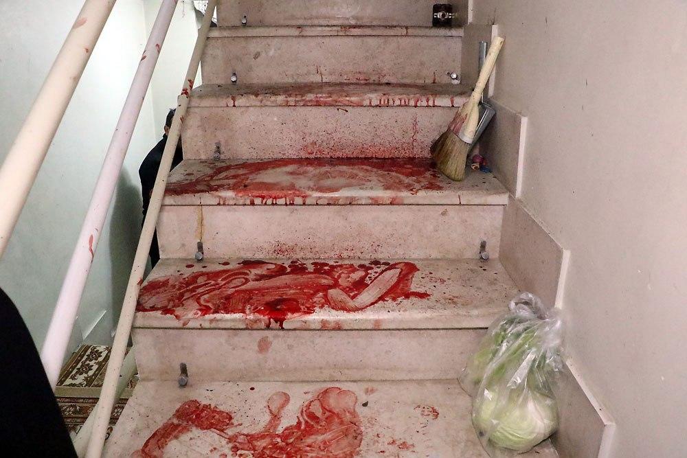 نخستین حادثه چهارشنبه‌سوری در مشهد با مجروحیت شدید جوان ترقه‌ساز+تصاویر