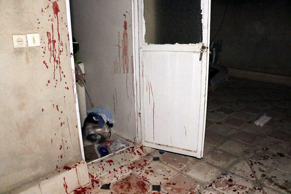 نخستین حادثه چهارشنبه‌سوری در مشهد با مجروحیت شدید جوان ترقه‌ساز+تصاویر