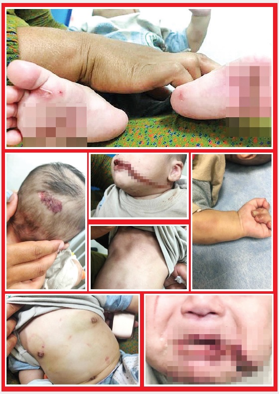 &laquo;آرمان&raquo;، قربانی نوزاد آزاری