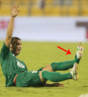 فیلم لحظه وحشتناک شکستن پای آندره گومز بازیکن اورتون+عکس