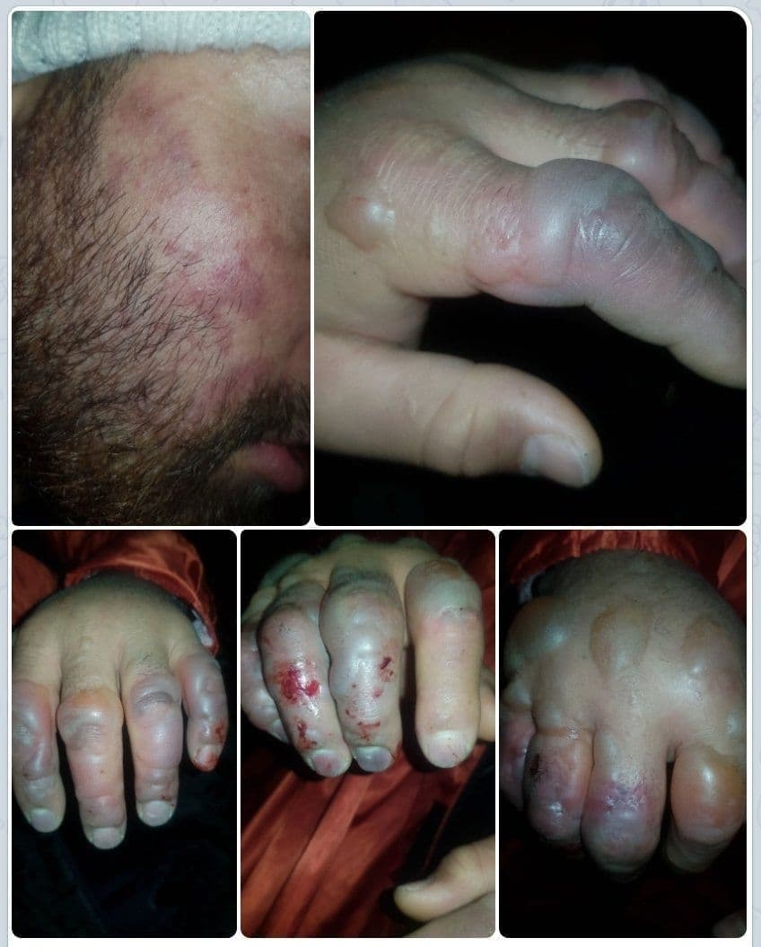 کوهنوردان گمشده در ارتفاعات دارآباد تهران + عکس و فیلم