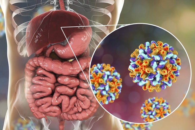 «هپاتیت A» چیست و چه علائمی دارد؟ | راه‌های انتقال هپاتیت چیست؟