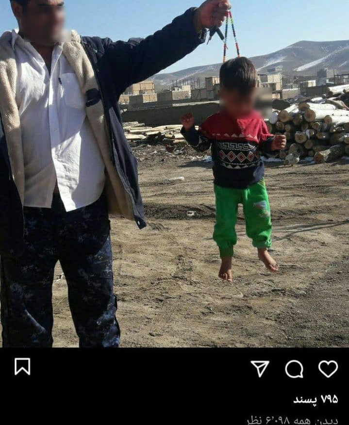 انتشار تصاویر تلخ از یک کودک آزاری در اینستاگرام + عکس انتشار تصاویر تلخ از یک کودک آزاری در اینستاگرام + عکس