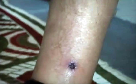 ماجرای عجیب عسگر، مارگزیده ترین مرد ایران + تصاویر