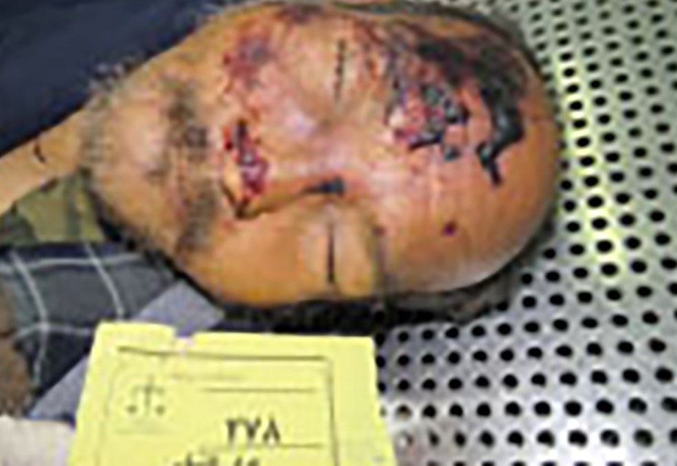 درخواست پلیس مشهد برای شناسایی جنازه یک مرد + عکس