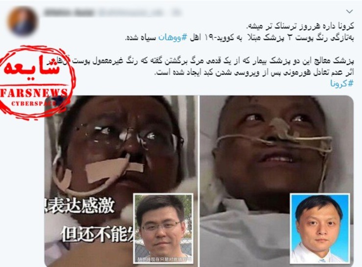 امروز برخی رسانه‌ها با انتشار این تصویر نوشتند: «پوست ۲ پزشک مبتلا به کووید-۱۹ سیاه شد»