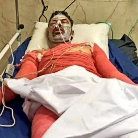 البرز زارعی ناجی زاگرس درگذشت البرز زارعی ناجی زاگرس درگذشت