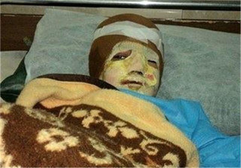 انفجار موبایل به دلیل استفاده از الکل منجر به مرگ معلم جوان شد + عکس انفجار موبایل به دلیل استفاده از الکل منجر به مرگ معلم جوان شد + عکس