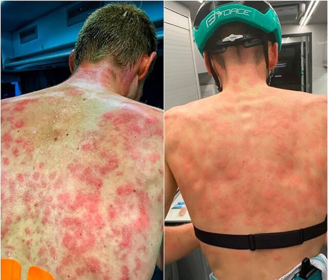 مصدومیت شدید دوچرخه‌سواران اروپایی با بارش بی‌موقع تگرگ+عکس