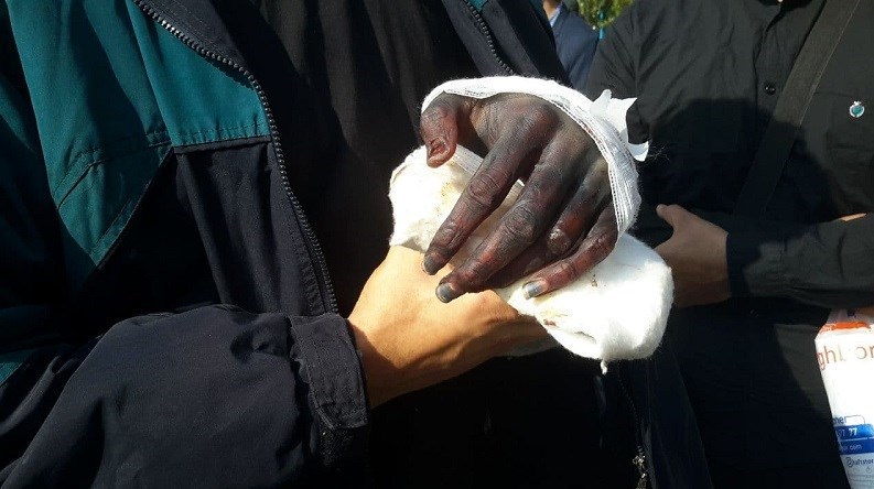 ماجرای قطع دست یک کشتی گیر توسط اراذل و اوباش + عکس ماجرای قطع دست یک کشتی گیر توسط اراذل و اوباش + عکس