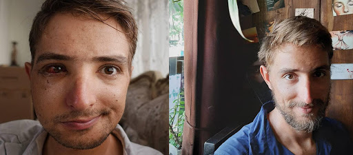 حکم جالب قاضی برای ضاربان &laquo;فیلیپ مارک گراف&raquo; دوچرخه سوار آلمانی + حکم دادگاه