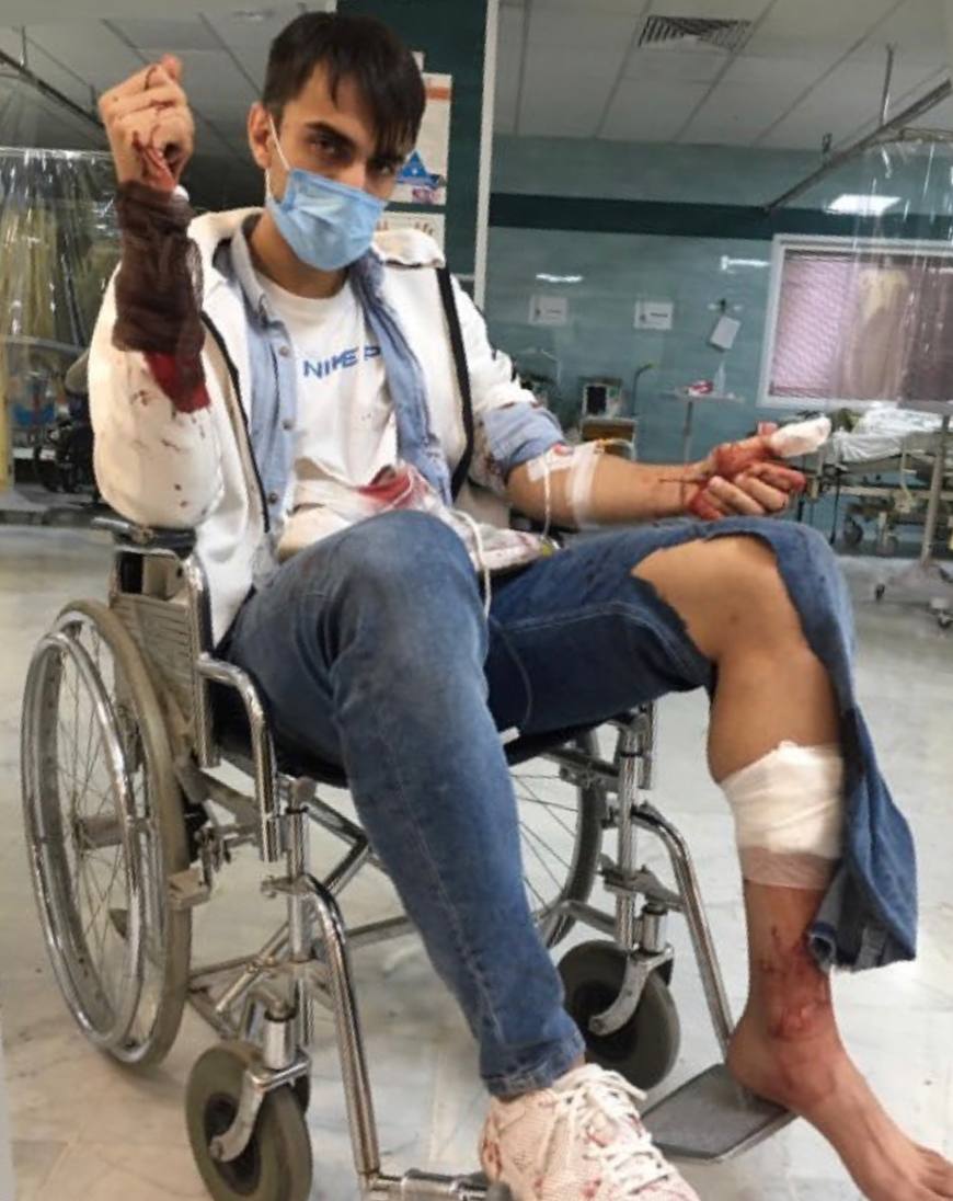 ضرب و جرح بازیکن لیگ برتری با چاقو و قمه+عکس