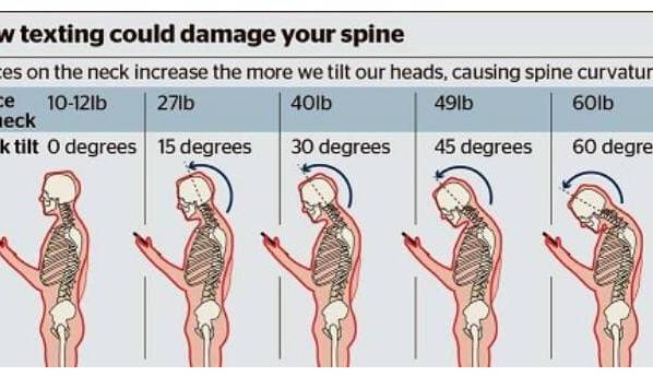 استفاده از تلفن همراه، سلامت گردن را تهدید میکند استفاده از تلفن همراه، سلامت گردن را تهدید میکند