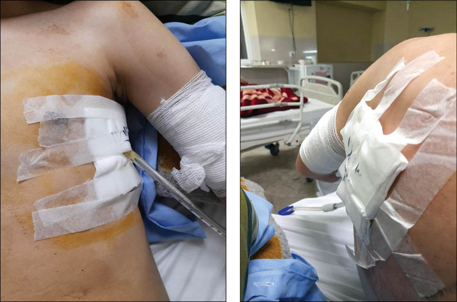 زورگیران سیاه پوش که ریه نوجوان مشهدی را شکافتند، دستگیر شدند زورگیران سیاه پوش که ریه نوجوان مشهدی را شکافتند، دستگیر شدند