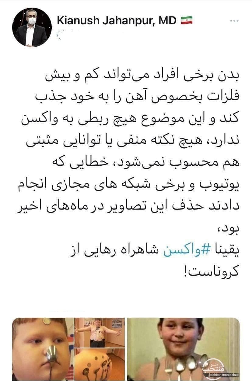 ماجرای آهنربایی شدن بدن پس از تزریق واکسن کرونا + فیلم ماجرای آهنربایی شدن بدن پس از تزریق واکسن کرونا + فیلم