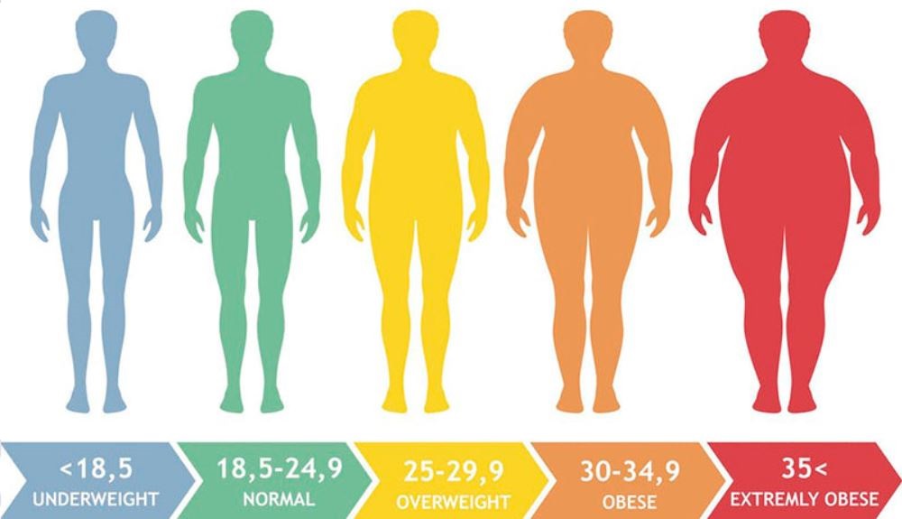 چاقی میتواند خطر عوارض بلندمدت کرونا را افزایش دهد چاقی میتواند خطر عوارض بلندمدت کرونا را افزایش دهد