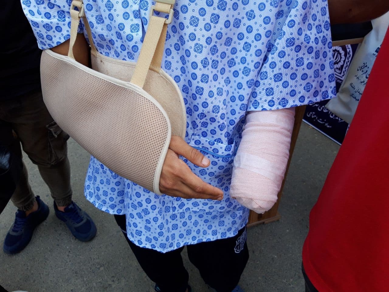 قطع دست جوان ۱۸ ساله تهرانی در درگیری خیابانی + فیلم و عکس قطع دست جوان ۱۸ ساله تهرانی در درگیری خیابانی + فیلم و عکس