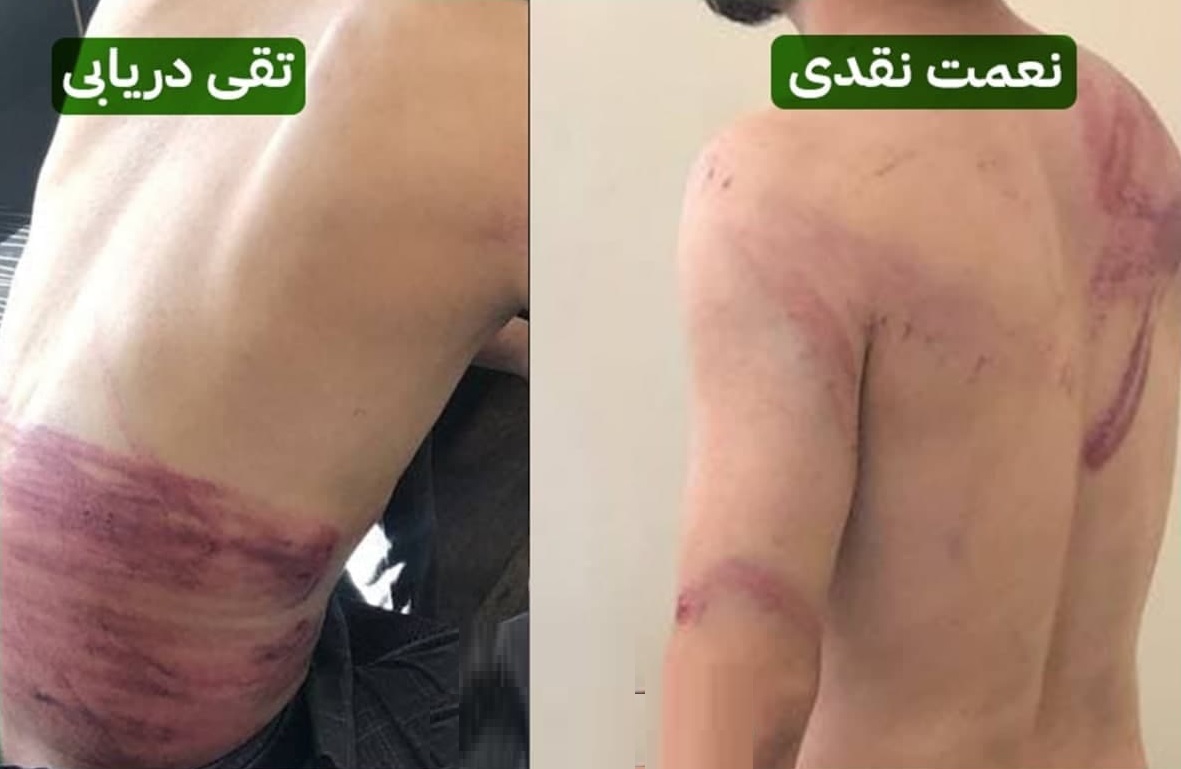 طالبان خبرنگاران افغان را لت و کوب کردند + فیلم و عکس طالبان خبرنگاران افغان را لت و کوب کردند + فیلم و عکس