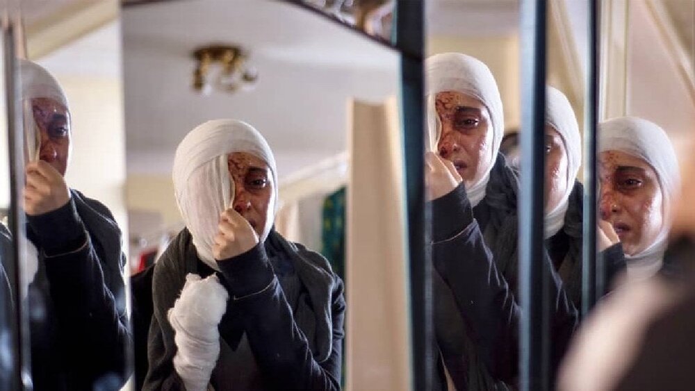 ماجرای اسید پاشی به صورت ترلان پروانه + عکس ماجرای اسید پاشی به صورت ترلان پروانه + عکس