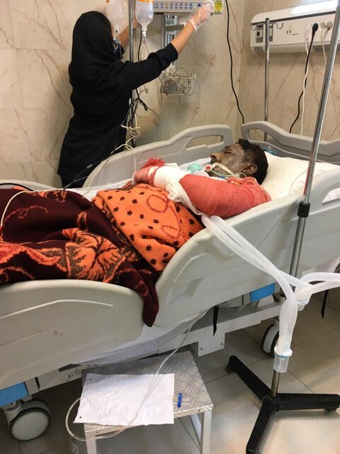 سوختگی شدید «سجاد رزمجو»، خواننده یاسوجی در پی انفجار منزلش + عکس سوختگی شدید «سجاد رزمجو»، خواننده یاسوجی در پی انفجار منزلش + عکس