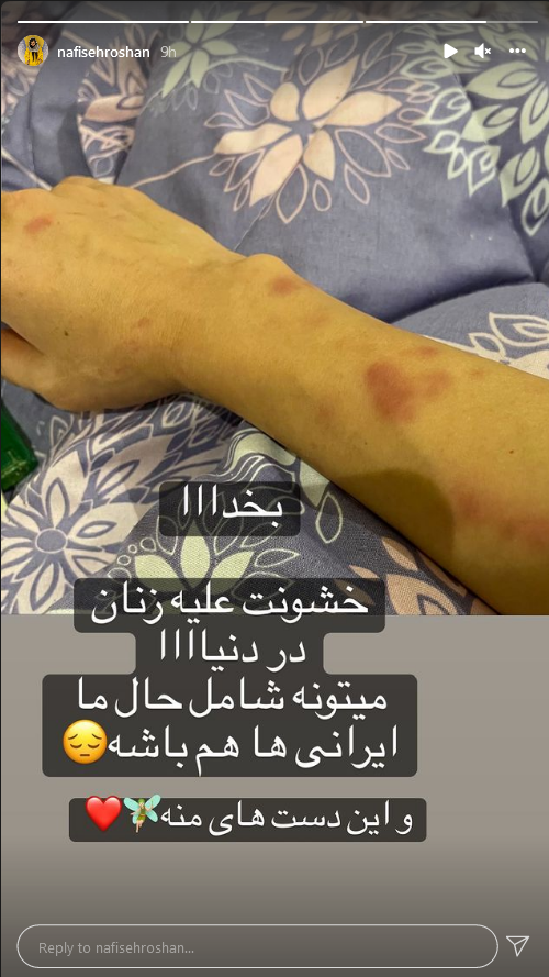 بدن زخمی نفیسه روشن و اعتراض او به خشونت علیه زنان + عکسها بدن زخمی نفیسه روشن و اعتراض او به خشونت علیه زنان + عکسها