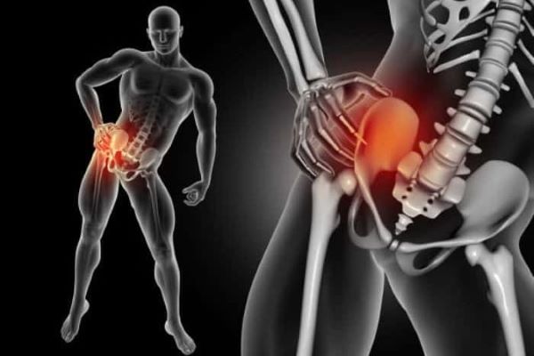علت بروز کلاپس مفصل ران چیست؟ علت بروز کلاپس مفصل ران چیست؟