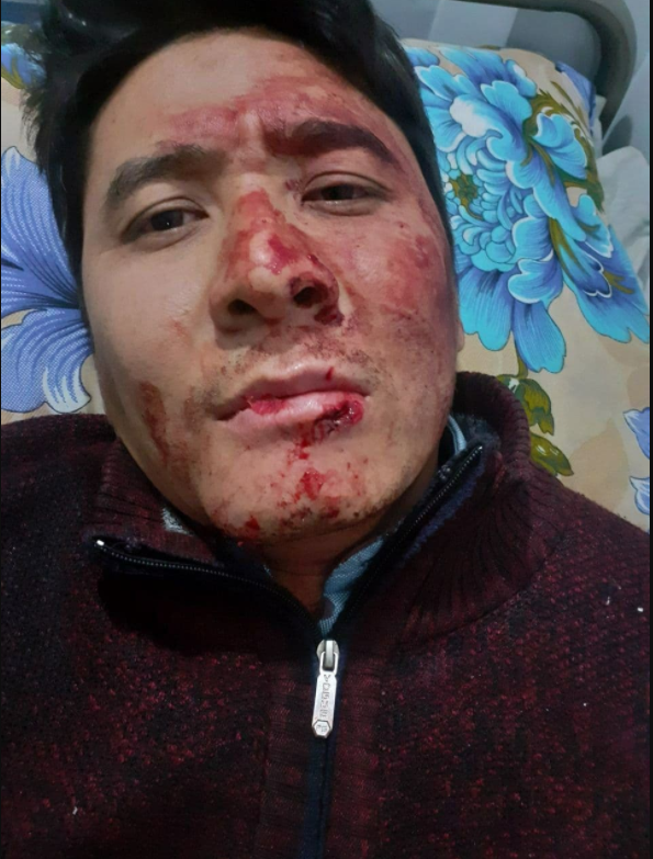 جزئیات ترور نافرجام تصویربردار صدا و سیما در کابل جزئیات ترور نافرجام تصویربردار صدا و سیما در کابل