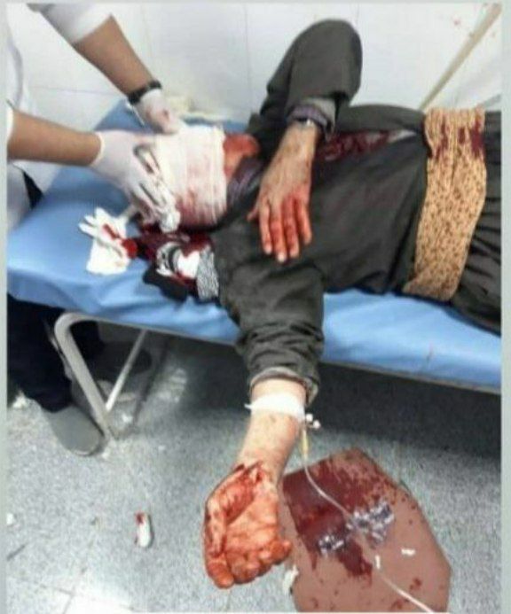 لحظه حمله گرگ به مردم در جوانرود کرمانشاه + فیلم و عکس لحظه حمله گرگ به مردم در جوانرود کرمانشاه + فیلم و عکس