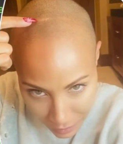 بیماری و علت تراشیدن موی همسر ویل اسمیت چیست؟ بیماری و علت تراشیدن موی همسر ویل اسمیت چیست؟