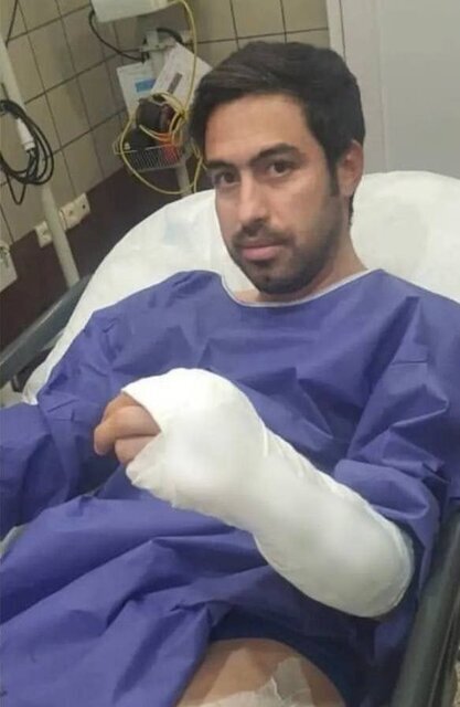 مجروحیت «خسرو حیدری» در اثر حمله زورگیرها+تصویر مجروحیت «خسرو حیدری» در اثر حمله زورگیرها+تصویر
