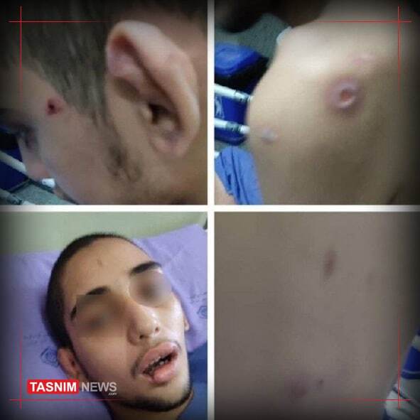 شکنجه وحشیانه یک ناتوان ذهنی در قائمشهر مازندران + تصاویر شکنجه وحشیانه یک ناتوان ذهنی در قائمشهر مازندران + تصاویر