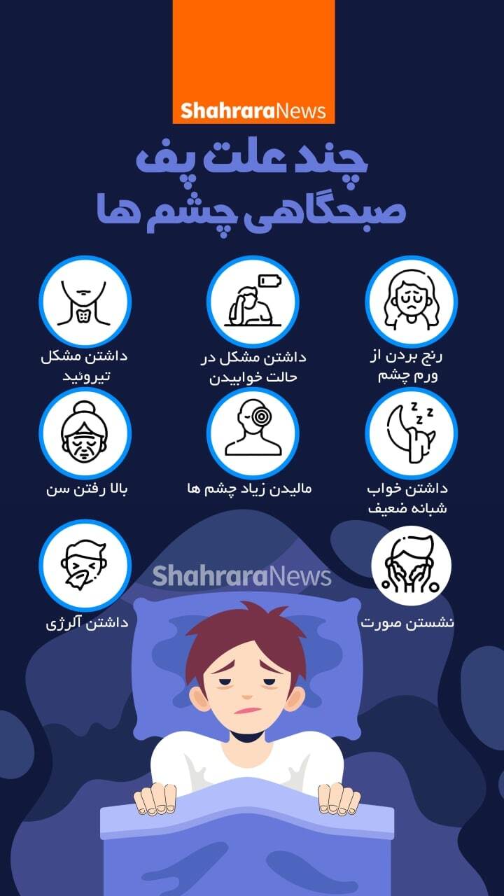 اینفوگرافی | چند علت پف صبحگاهی چشم&zwnj;ها