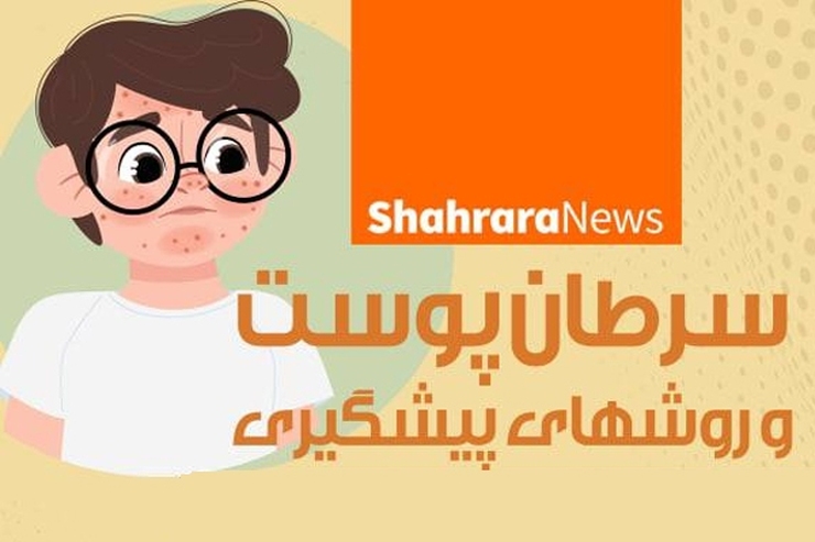 اینفوگرافی | سرطان پوست و روش‌های پیشگیری