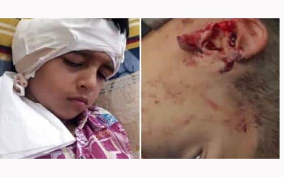 سگهای ولگرد گوش کودک اهوازی را خوردند! + عکس سگهای ولگرد گوش کودک اهوازی را خوردند! + عکس