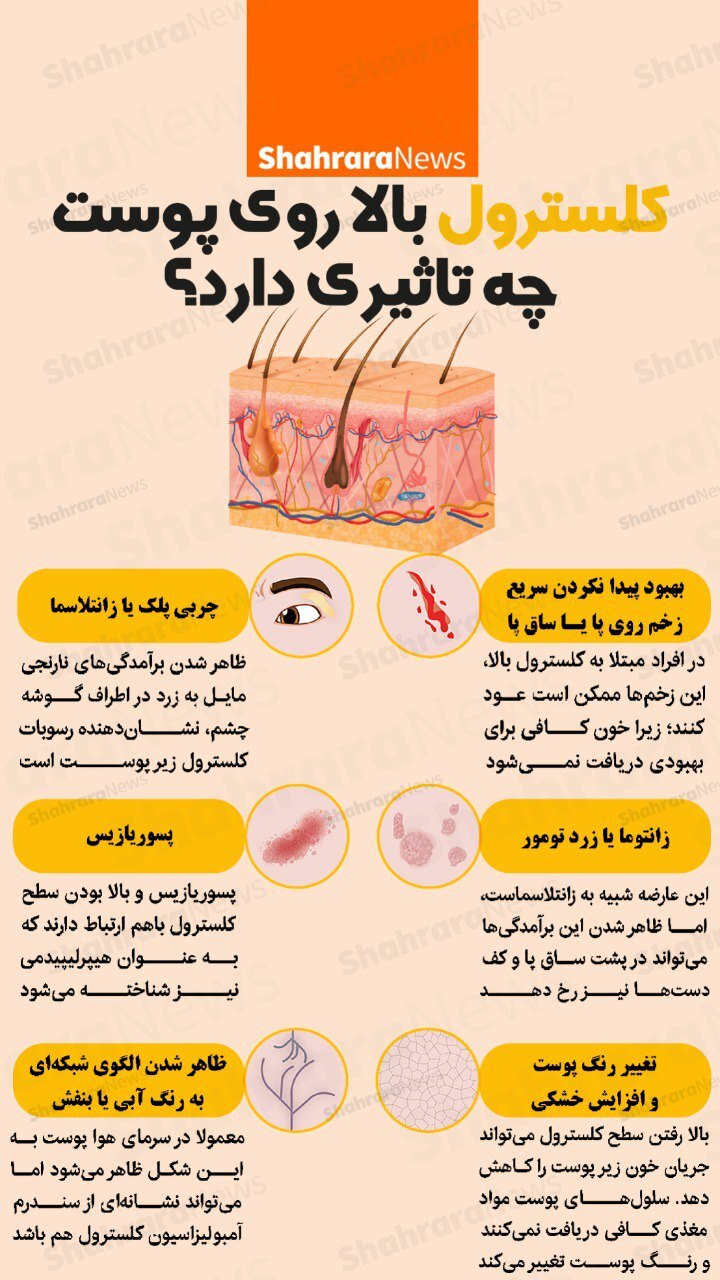 اینفوگرافی| کلسترول بالای روی پوست چه تاثیری دارد؟