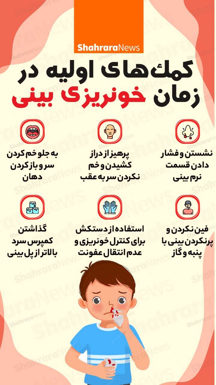 اینفوگرافی| کمک‌های اولیه در زمان خونریزی بینی