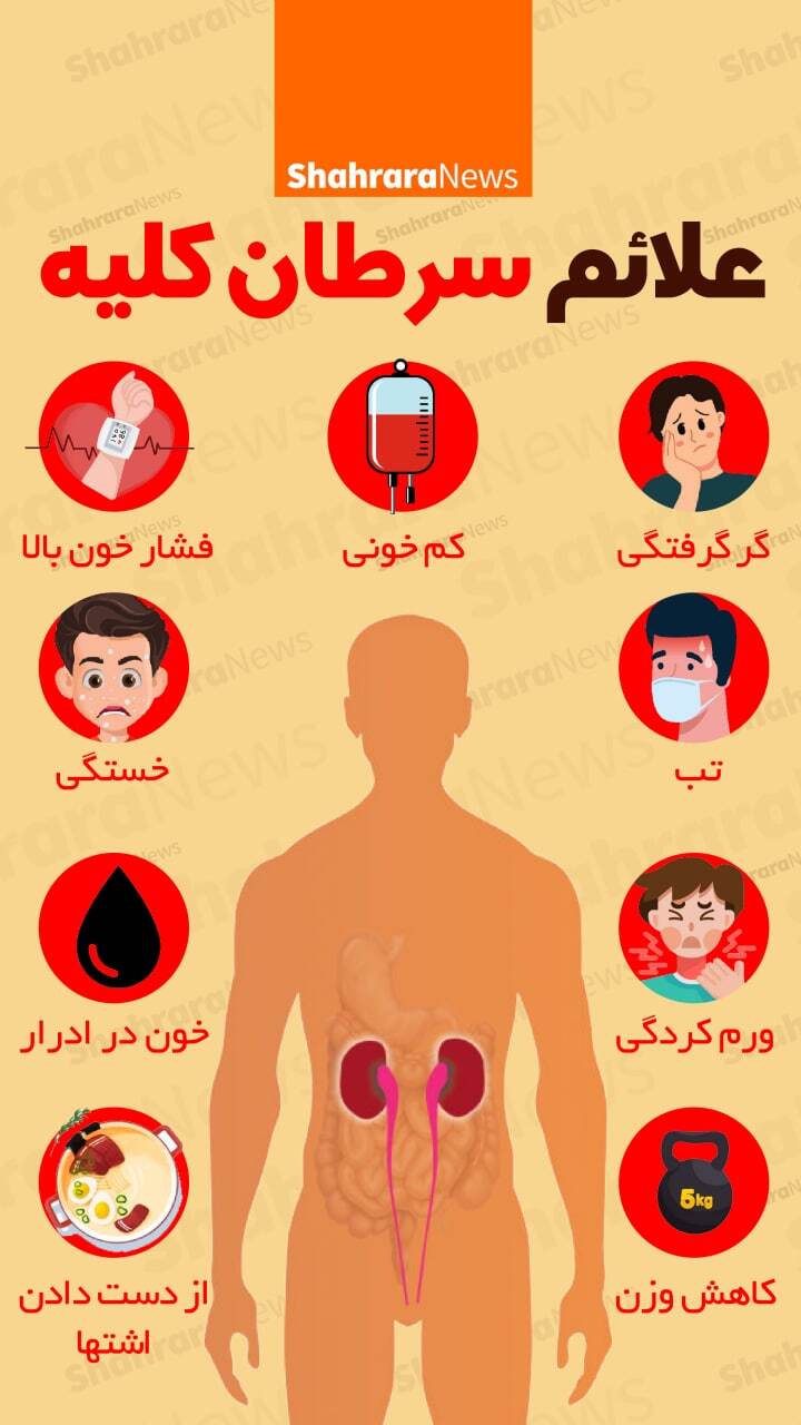 اینفوگرافی| علائم سرطان کلیه