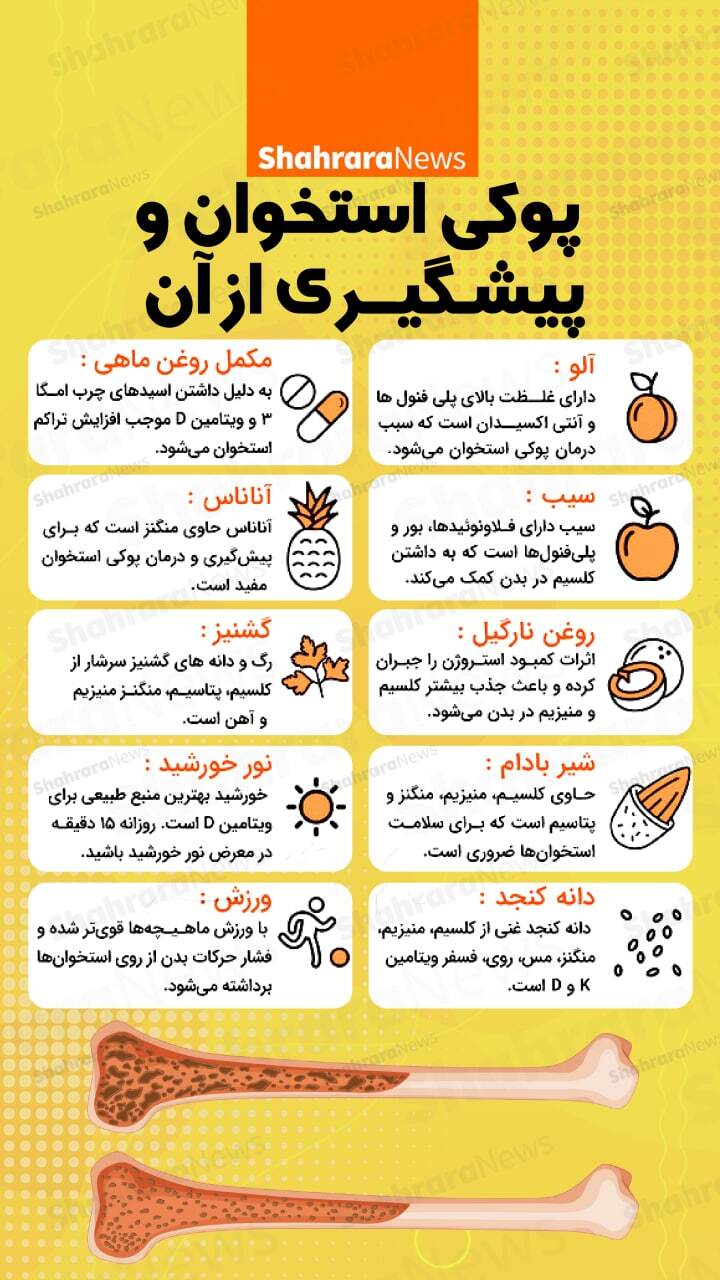 اینفوگرافی| پوکی استخوان و پیشگیری از آن