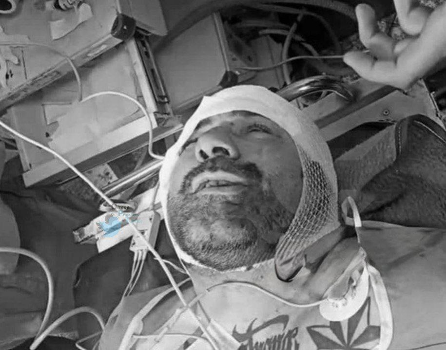 اولین تصویر از «هانی کرده» در اورژانس بیمارستان منتشر شد اولین تصویر از «هانی کرده» در اورژانس بیمارستان منتشر شد