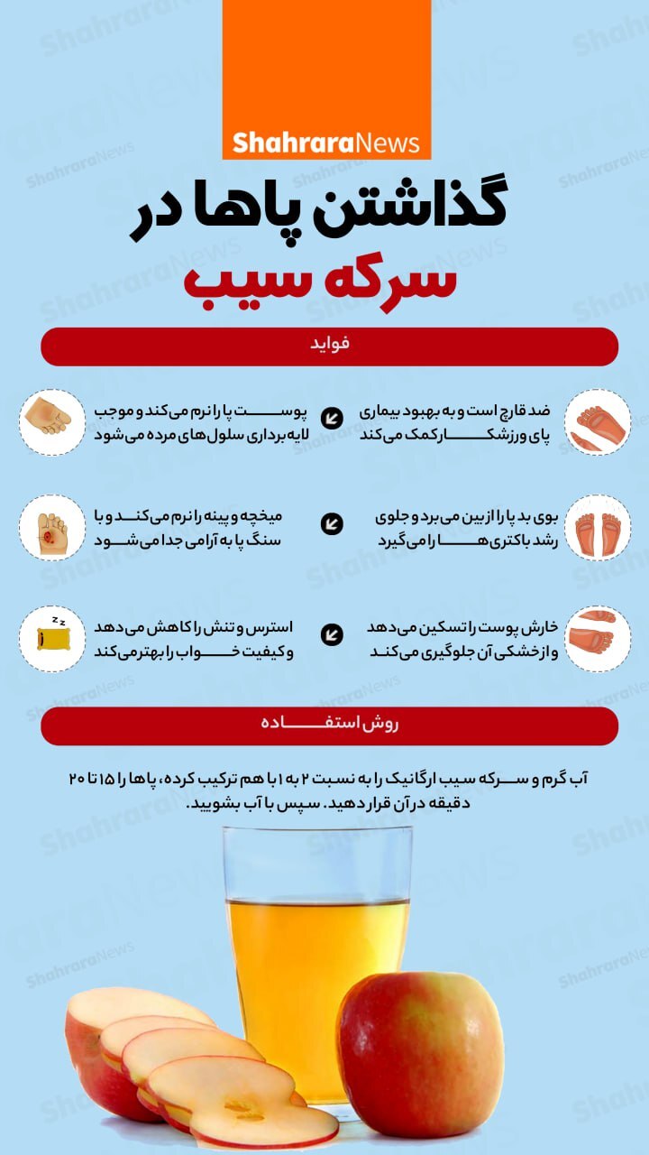 اینفوگرافی| گذاشتن پاها در سیب