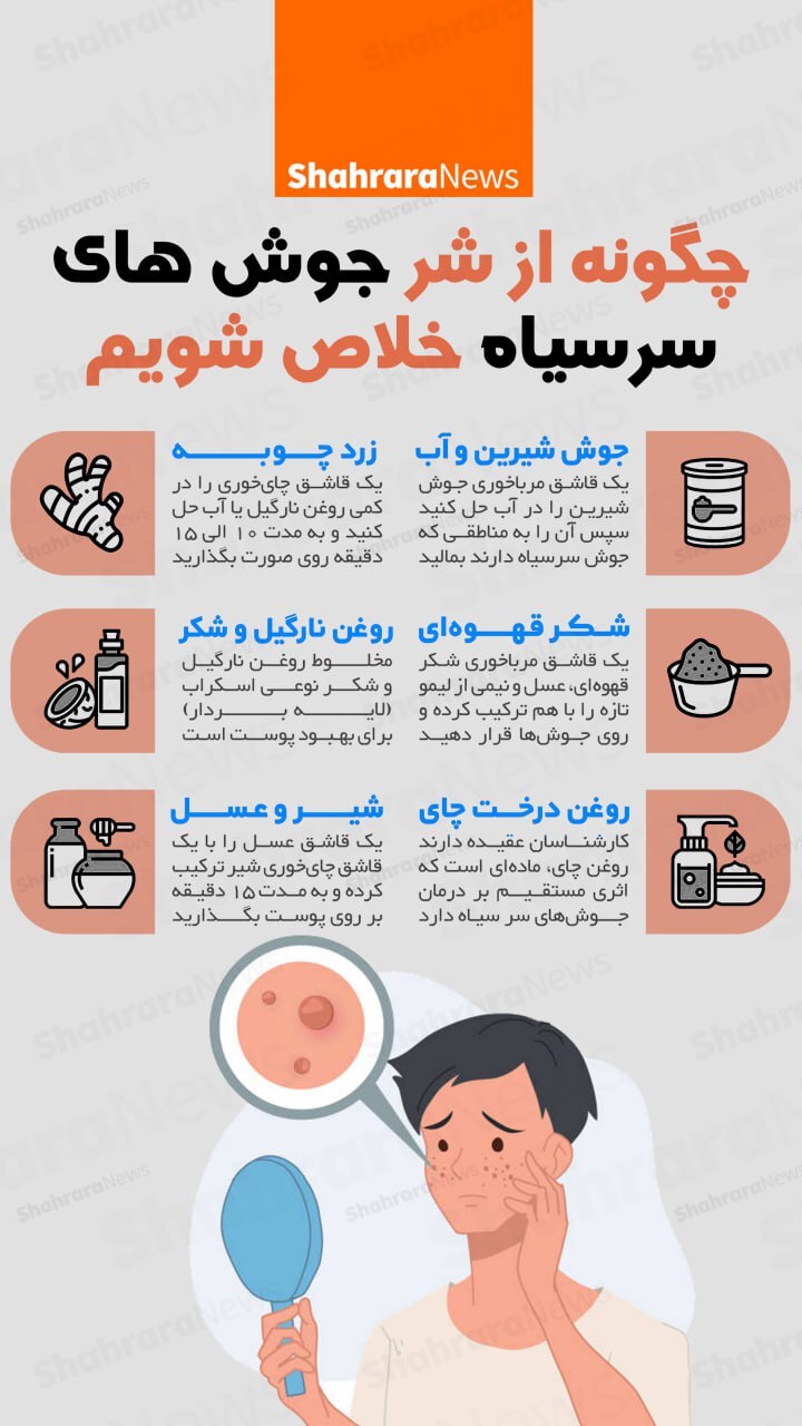 اینفوگرافی| چگونه از شر جوش‌های سر سیاه خلاص شویم؟