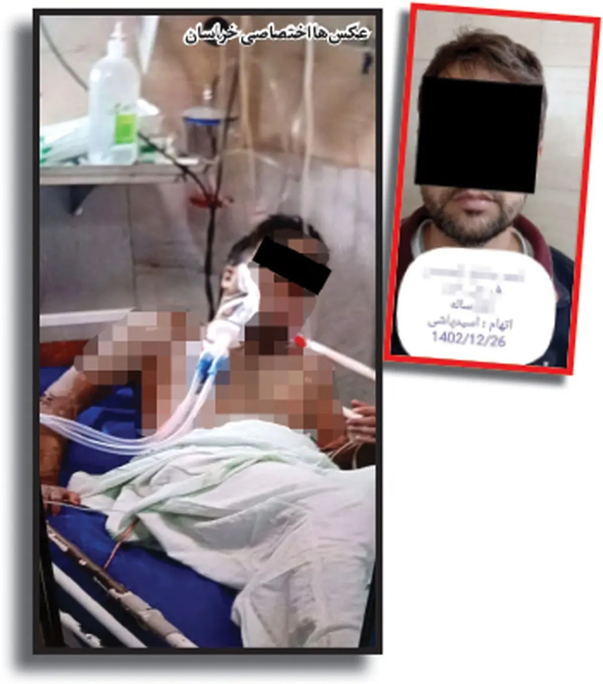 اسیدپاشی بر روی مرد جوان مشهدی با تصور خیانت + عکس اسیدپاشی بر روی مرد جوان مشهدی با تصور خیانت + عکس