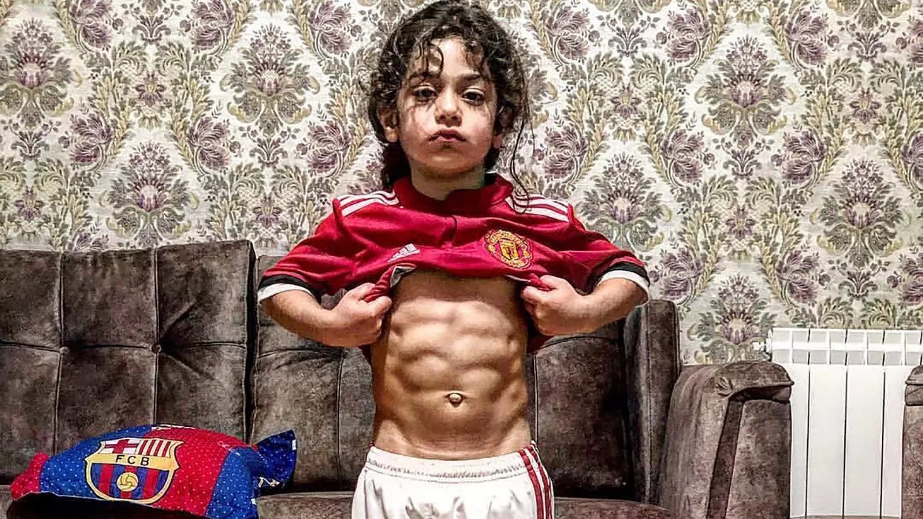 آیا آرات حسینی دچار مشکلات جسمی و روحی شده است؟ + جزئیات