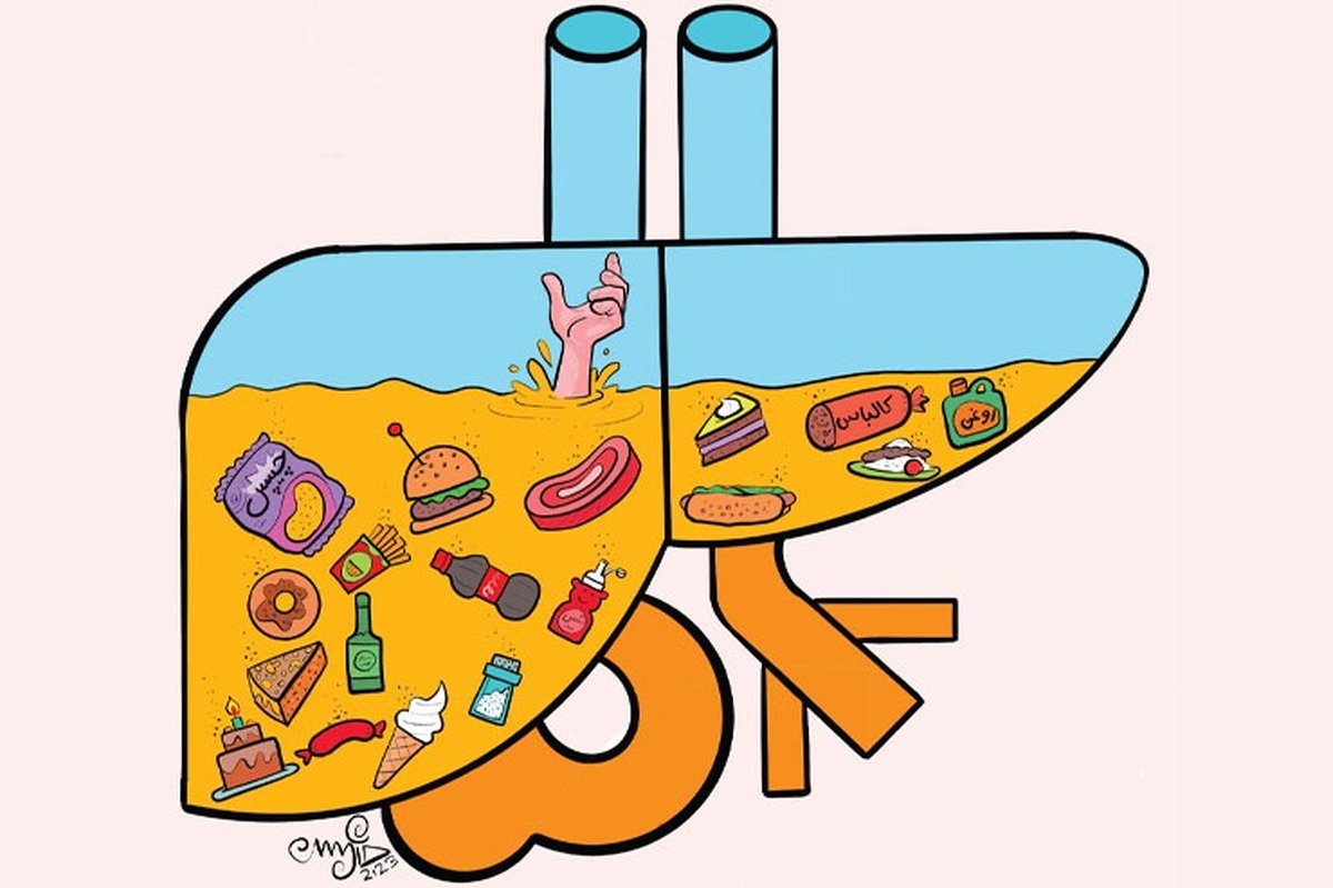 چگونه از کبدمان محافظت کنیم؟