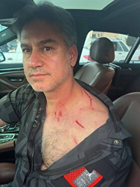 سرقت خشن از حمید مطهری، مربی تیم ملی + تصاویر