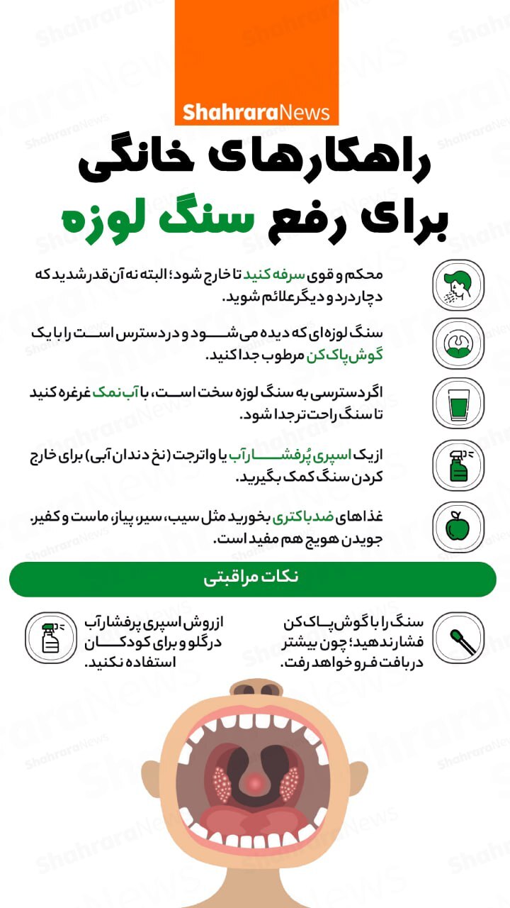 اینفوگرافی| راهکارهای خانگی برای رفع سنگ لوزه