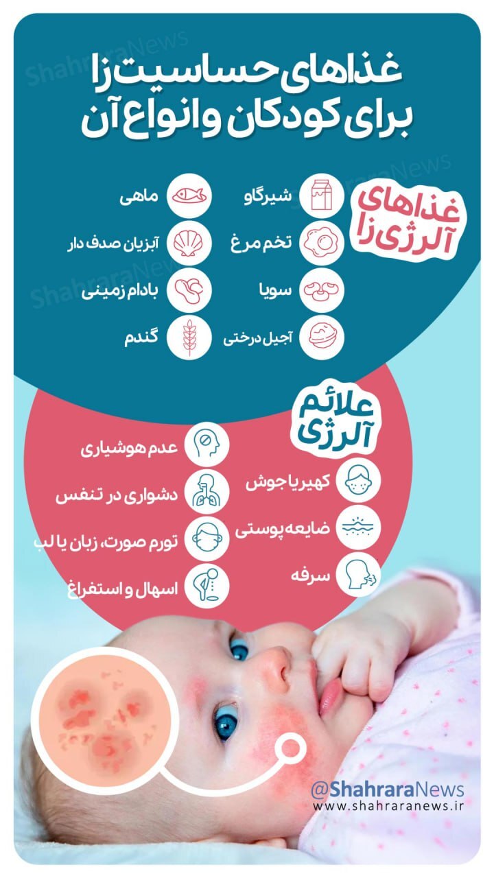 اینفوگرافی| غذاهای حساسیت زا برای کودکان و انواع آن