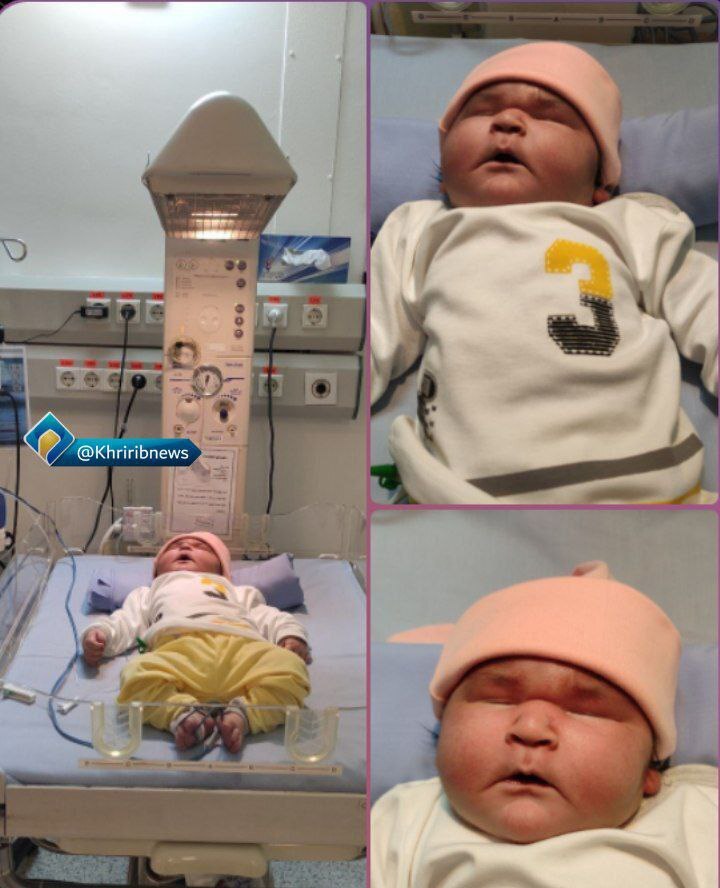 اولین تصاویر از نوزاد ۷ کیلویی متولد شده در مشهد