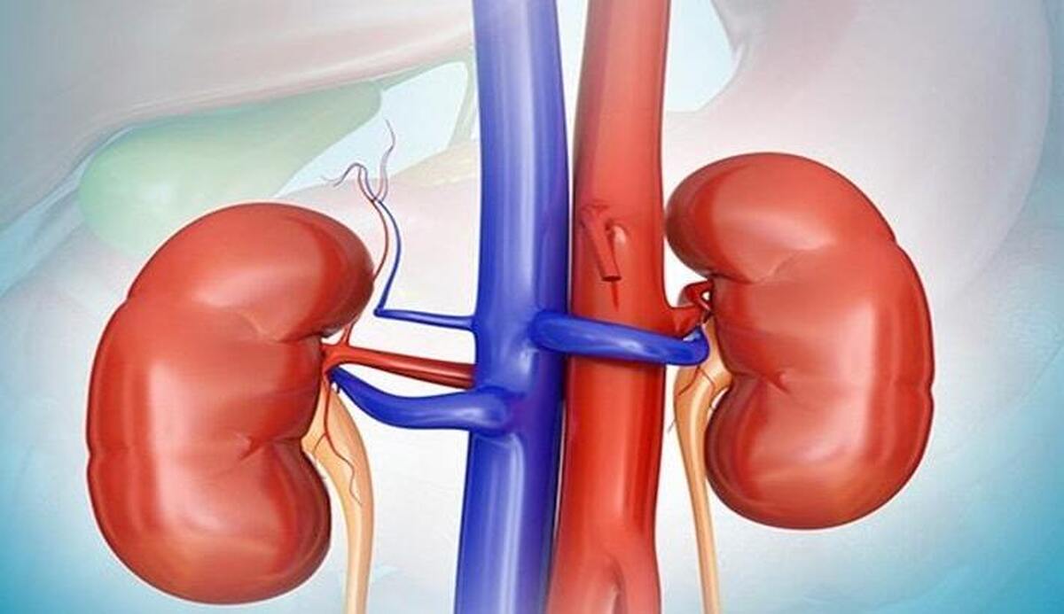 ۴ نوشیدنی معجزه‌گر برای درمان سنگ کلیه